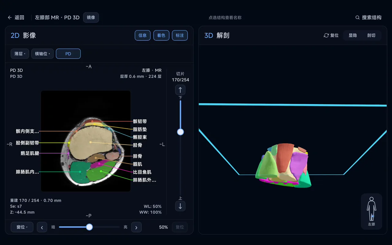 实机演示：拖动二维切片，三维膝关节模型同步剖切